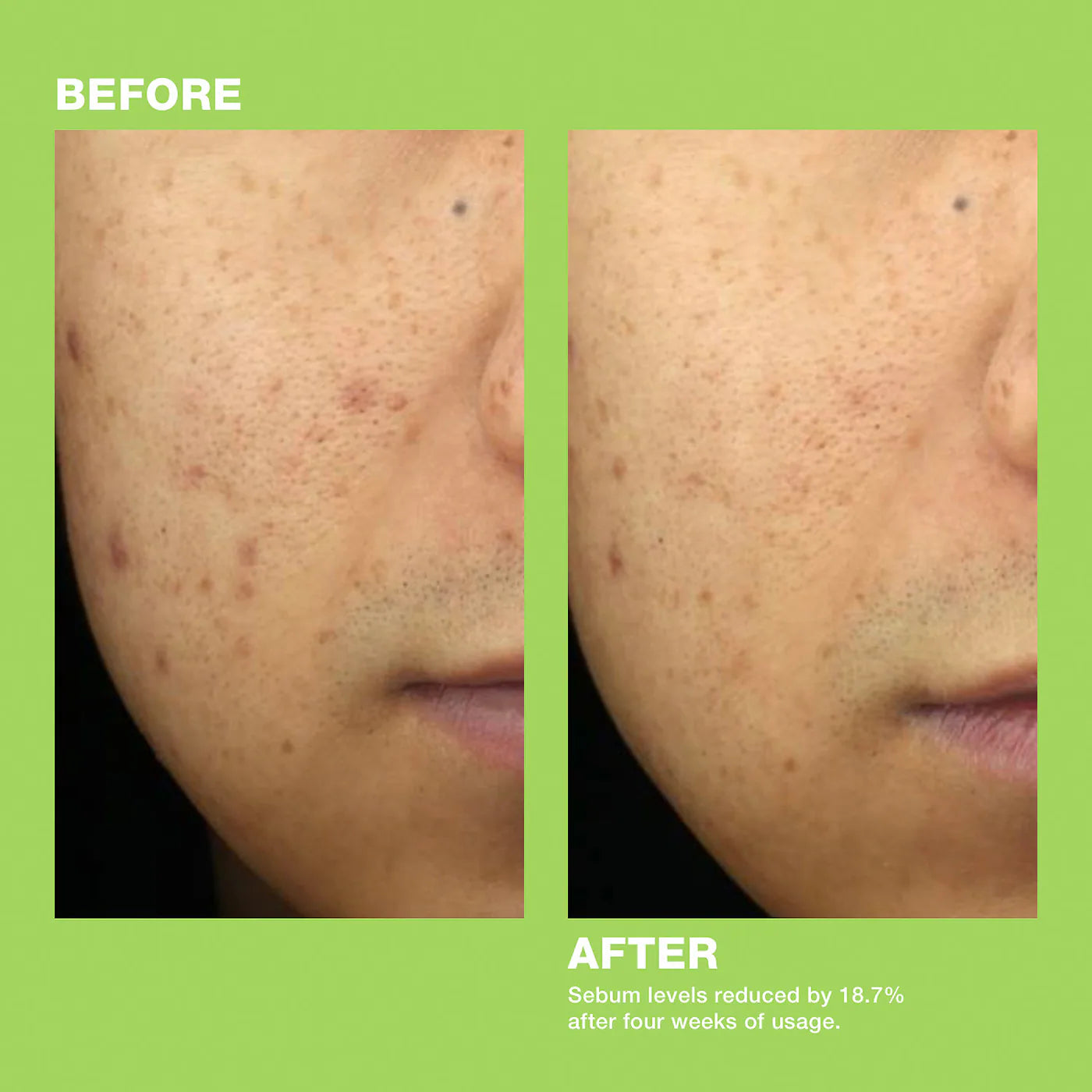 Dr.Jart+ Ctrl-A Teatreement Moisturizer